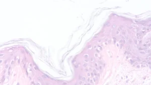 Fondo cabecera sintergética en el dolor